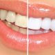 clinica-dental-los-remedios4
